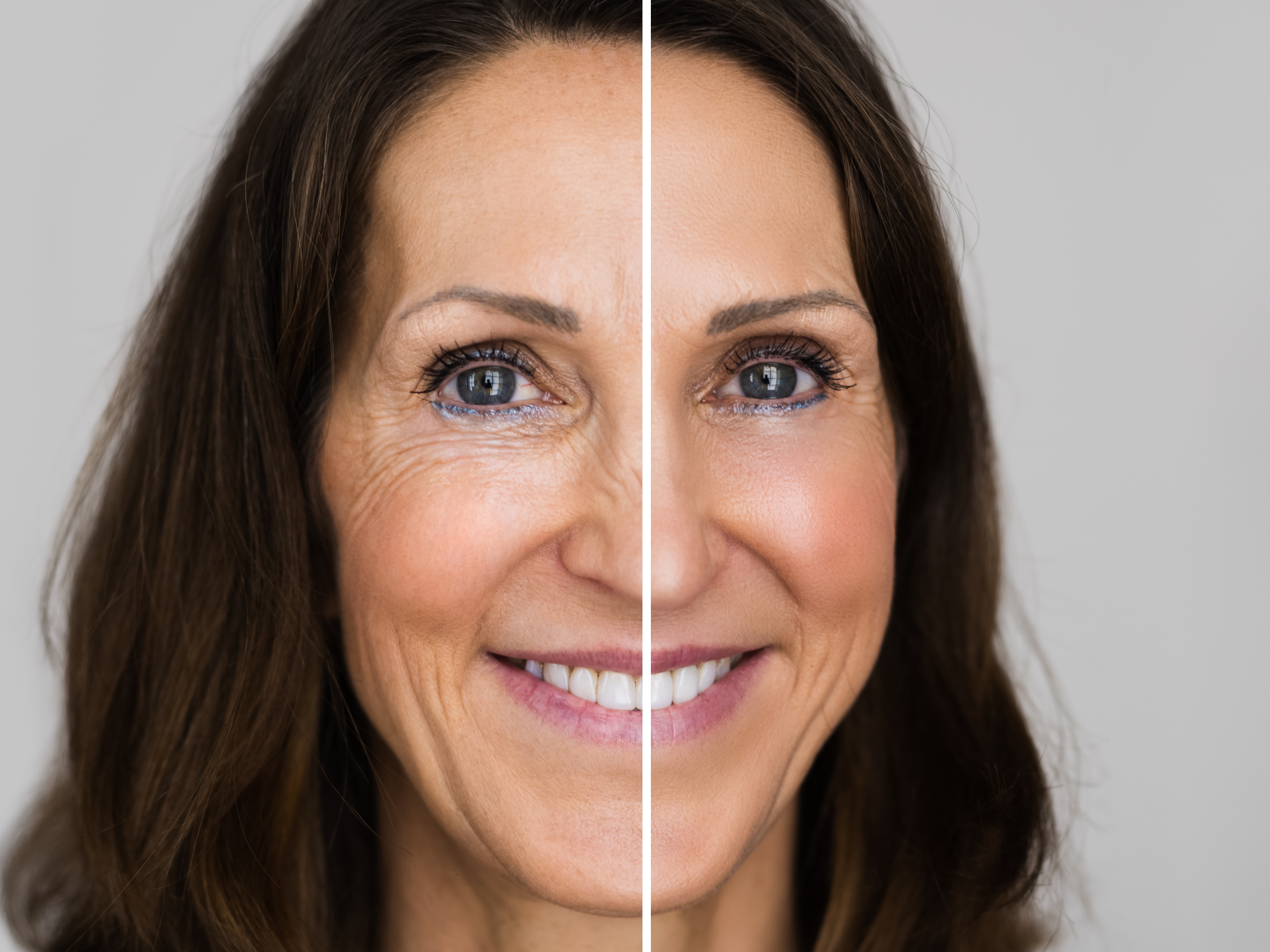 Comparativa de rejuvenecimiento facial sin cirugía